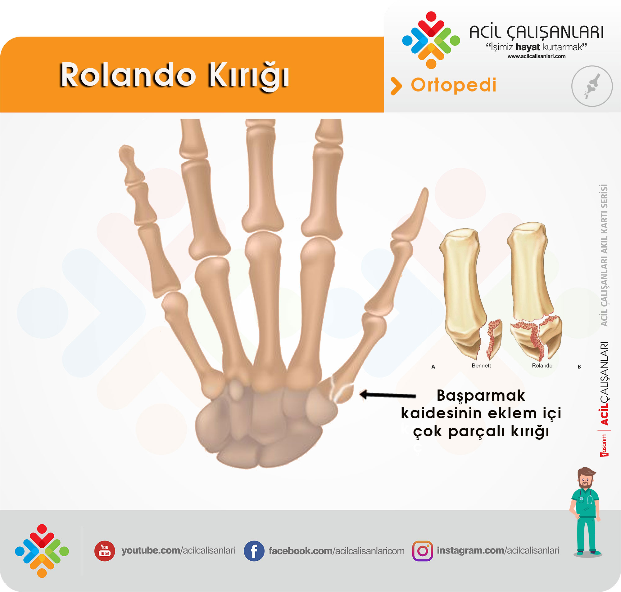 Rolando Kirigi Akil Karti Acil Calisanlari