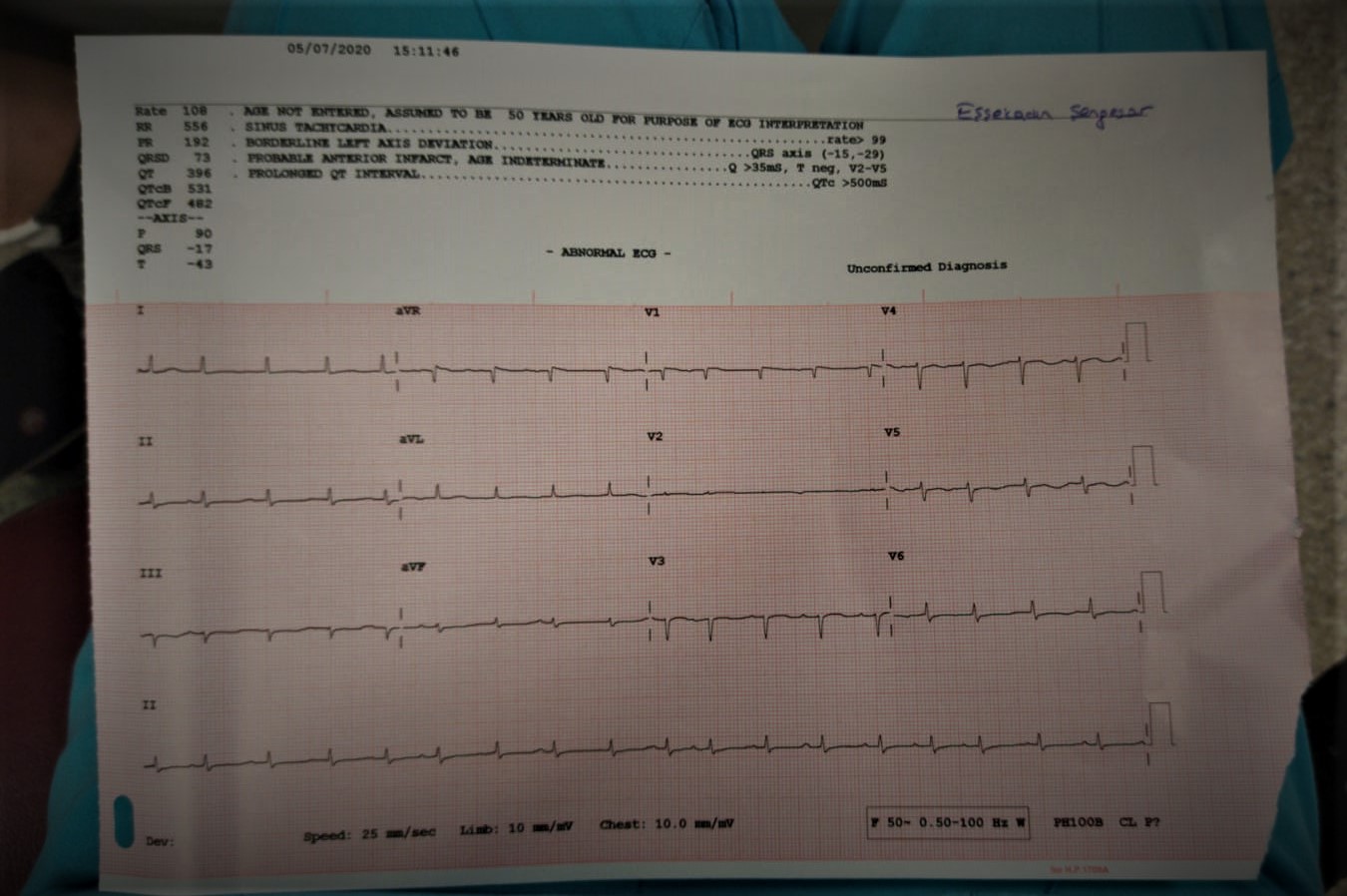 ekg mat | Acil Çalışanları