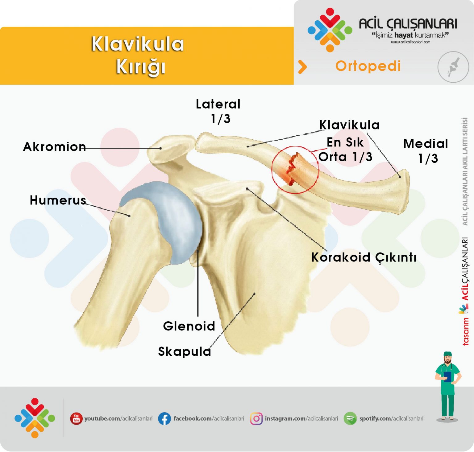 Klavikula Kırığı - Acil Çalışanları